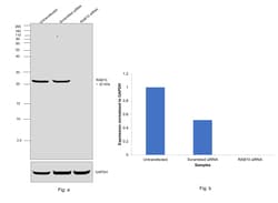 Invitrogen RAB10 Polyclonal Antibody 100 &mu;g; Unconjugated:Antibodies,
