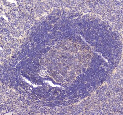 Invitrogen RAB27A Polyclonal Antibody 100 &mu;g; Unconjugated:Antibodies,