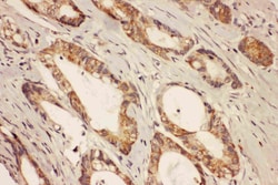 Invitrogen RAB8A Polyclonal Antibody 100 &mu;g; Unconjugated:Antibodies,