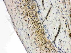 Invitrogen RAG2 Polyclonal Antibody 100 &mu;g | Buy Online | Invitrogen&trade; | Fisher Scientific