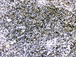 Invitrogen RAG2 Polyclonal Antibody 100 &mu;g | Buy Online | Invitrogen&trade; | Fisher Scientific