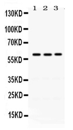 Invitrogen RAG2 Polyclonal Antibody 100 &mu;g | Buy Online | Invitrogen&trade; | Fisher Scientific