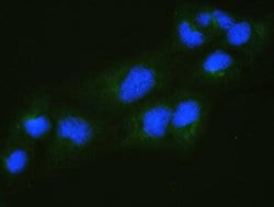 Invitrogen RALBP1 Polyclonal Antibody 100 &mu;g; Unconjugated:Antibodies,