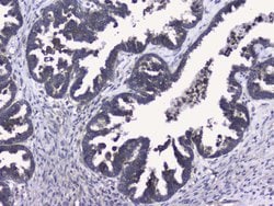 Invitrogen RALBP1 Polyclonal Antibody 100 &mu;g; Unconjugated:Antibodies,