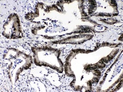 Invitrogen RAN Polyclonal Antibody 100 &mu;g; Unconjugated:Antibodies,