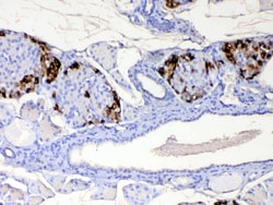 Invitrogen RBP4 Polyclonal Antibody 100 &mu;g | Buy Online | Invitrogen&trade; | Fisher Scientific