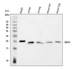 Invitrogen RBP4 Polyclonal Antibody 100 &mu;g | Buy Online | Invitrogen&trade; | Fisher Scientific