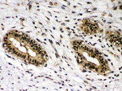 Invitrogen c-Rel Polyclonal Antibody 100 &mu;g; Unconjugated:Antibodies,