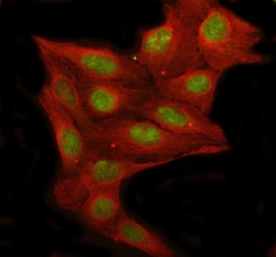 Invitrogen RFC1 Polyclonal Antibody 100 &mu;g; Unconjugated:Antibodies,