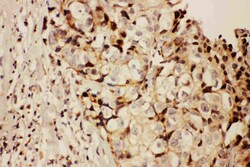 Invitrogen RFC1 Polyclonal Antibody 100 &mu;g; Unconjugated:Antibodies,