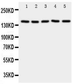 Invitrogen RFC1 Polyclonal Antibody 100 &mu;g; Unconjugated:Antibodies,