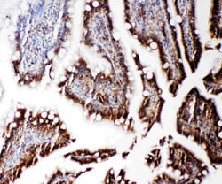 Invitrogen RGS3 Polyclonal Antibody 100 &mu;g | Buy Online | Invitrogen&trade; | Fisher Scientific
