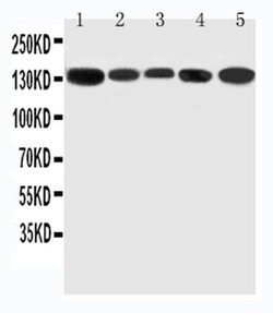 Invitrogen RGS3 Polyclonal Antibody 100 &mu;g | Buy Online | Invitrogen&trade; | Fisher Scientific