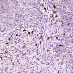 Invitrogen RNASE3 Polyclonal Antibody 100 &mu;g; Unconjugated:Antibodies,