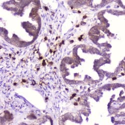 Invitrogen RNASE3 Polyclonal Antibody 100 &mu;g; Unconjugated:Antibodies,