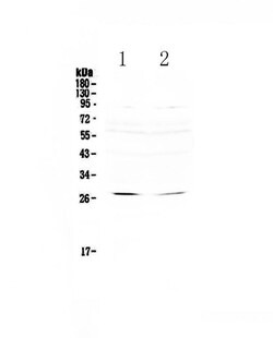 Invitrogen RNF186 Polyclonal Antibody 100 &mu;g; Unconjugated:Antibodies,