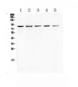 Invitrogen RNF43 Polyclonal Antibody 100 &mu;g; Unconjugated:Antibodies,