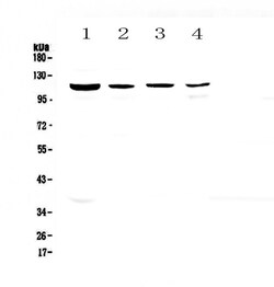 Invitrogen RPGR Polyclonal Antibody 100 &mu;g; Unconjugated:Antibodies,