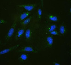 Invitrogen RPL19 Polyclonal Antibody 100 &mu;g; Unconjugated:Antibodies,