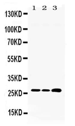 Invitrogen RPL19 Polyclonal Antibody 100 &mu;g; Unconjugated:Antibodies,