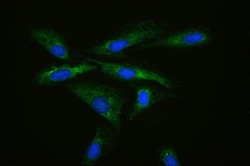 Invitrogen MPS1 Polyclonal Antibody 100 &mu;g; Unconjugated:Antibodies,