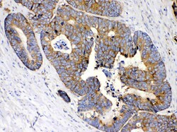 Invitrogen MPS1 Polyclonal Antibody 100 &mu;g; Unconjugated:Antibodies,