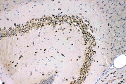 Invitrogen MPS1 Polyclonal Antibody 100 &mu;g; Unconjugated:Antibodies,