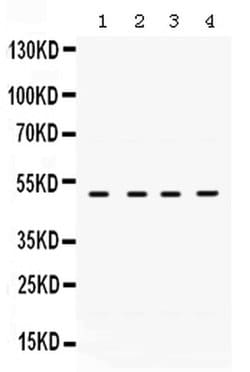 Invitrogen RRM2 Polyclonal Antibody 100 &mu;g; Unconjugated:Antibodies,