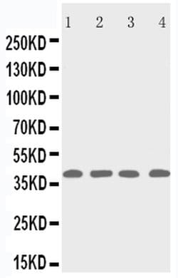 Invitrogen p53R2 Polyclonal Antibody 100 &mu;g; Unconjugated:Antibodies,