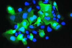 Invitrogen S100A7 Polyclonal Antibody 100 &mu;g; Unconjugated:Antibodies,