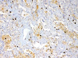 Invitrogen S100A7 Polyclonal Antibody 100 &mu;g; Unconjugated:Antibodies,