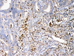 Invitrogen S100A7 Polyclonal Antibody 100 &mu;g; Unconjugated:Antibodies,