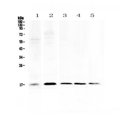 Invitrogen S100A7 Polyclonal Antibody 100 &mu;g; Unconjugated:Antibodies,