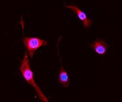 Invitrogen S100A8 Polyclonal Antibody 100 μg; Unconjugated:Antibodies,