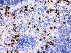 Invitrogen S100A8 Polyclonal Antibody 100 μg; Unconjugated:Antibodies,