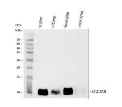 Invitrogen S100A8 Polyclonal Antibody 100 μg; Unconjugated:Antibodies,