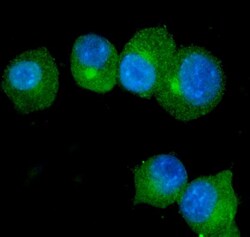 Invitrogen S100A9 Polyclonal Antibody 100 &mu;g; Unconjugated:Antibodies,