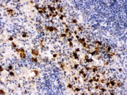 Invitrogen S100A9 Polyclonal Antibody 100 &mu;g; Unconjugated:Antibodies,