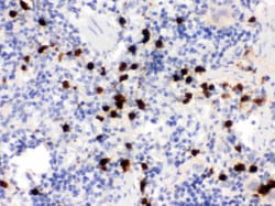Invitrogen S100A9 Polyclonal Antibody 100 &mu;g; Unconjugated:Antibodies,