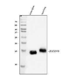 Invitrogen S100A9 Polyclonal Antibody 100 &mu;g; Unconjugated:Antibodies,