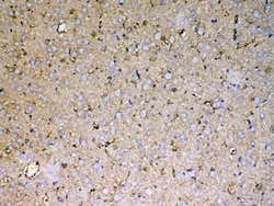 Invitrogen Sacsin Polyclonal Antibody 100 &mu;g; Unconjugated:Antibodies,