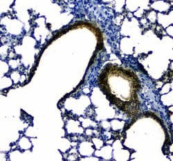 Uteroglobin Polyclonal Antibody:Antibodies, Polyclonal
