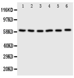 Invitrogen SCLY Polyclonal Antibody 100 &mu;g | Buy Online | Invitrogen&trade; | Fisher Scientific
