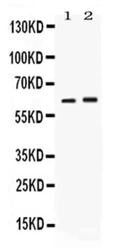 Invitrogen SCTR Polyclonal Antibody 100 &mu;g; Unconjugated:Antikörper