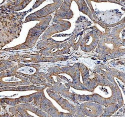Invitrogen SDHA Polyclonal Antibody 100 &mu;g; Unconjugated:Antibodies,