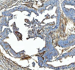Invitrogen SDHA Polyclonal Antibody 100 &mu;g; Unconjugated:Antibodies,