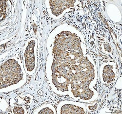 Invitrogen SDHA Polyclonal Antibody 100 &mu;g; Unconjugated:Antibodies,