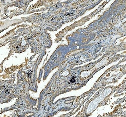 Invitrogen SDHA Polyclonal Antibody 100 &mu;g; Unconjugated:Antibodies,