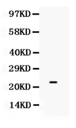 Invitrogen SECTM1 Polyclonal Antibody 100 &mu;g; Unconjugated:Antibodies,