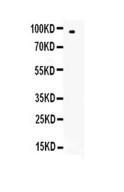 Invitrogen L-Selectin (CD62L) Polyclonal Antibody 100 &mu;g; Unconjugated:Antibodies,